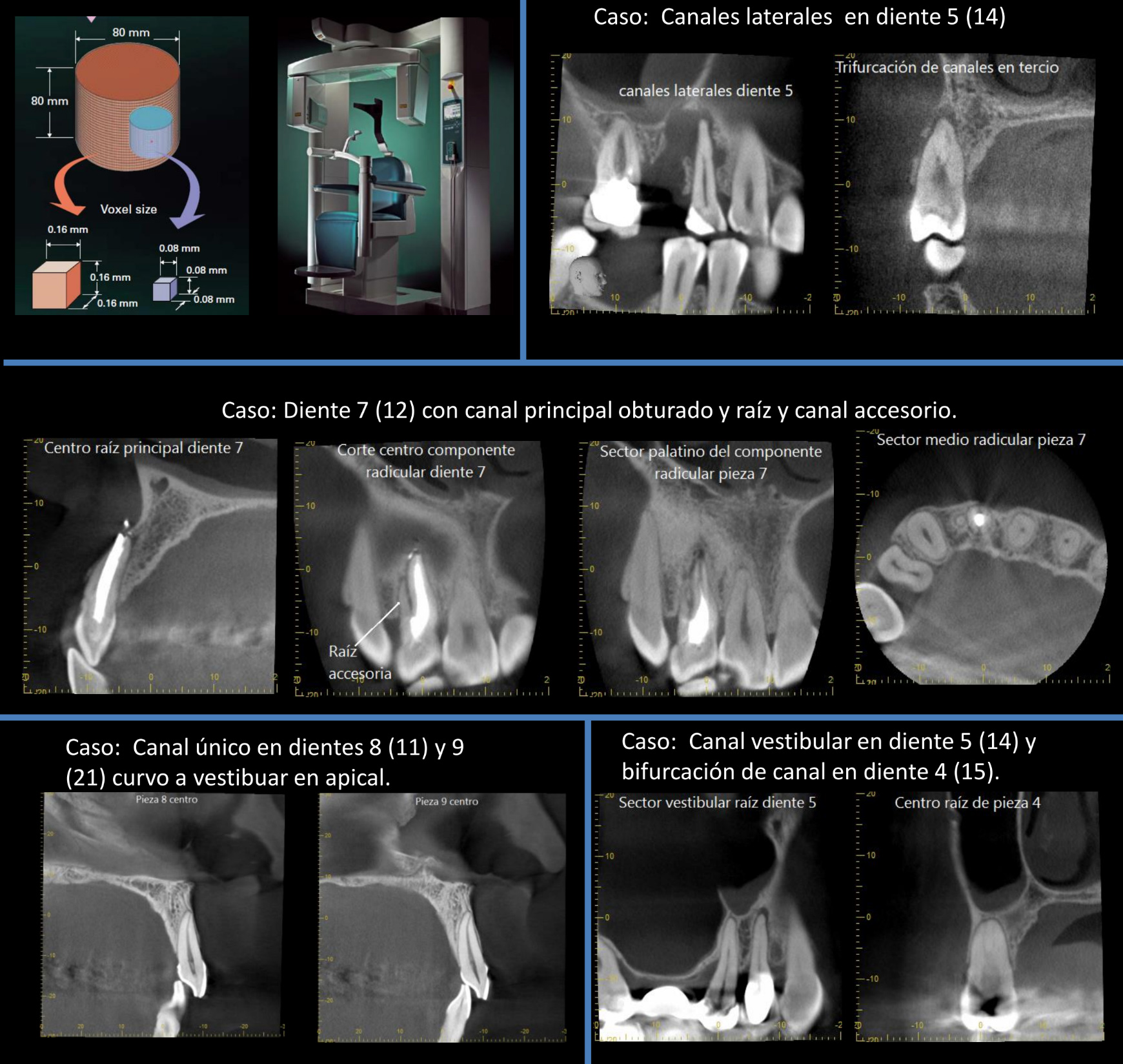 caso-tomografia-cone-beam1